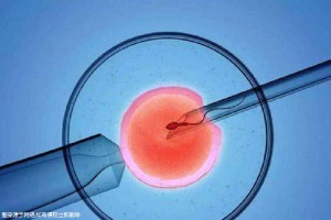 有偿孕妈借卵代怀咨询怎么选试管婴儿中心